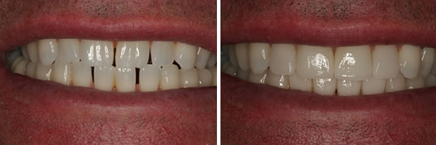 Detroit Dentist Before - After 28