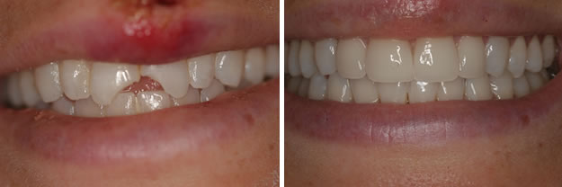 Detroit Dentist Before - After 33