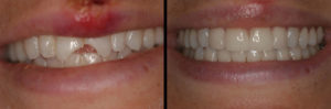 Detroit Dentist Before - After 35